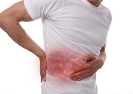پیشگیری از سنگ کلیه با چند عادت ساده